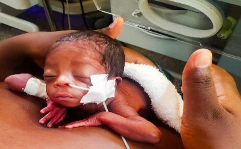 Um bebê recém-nascido descansa pele-a-pele no peito de sua mãe dias após nascer prematuramente no Hospital Geral de Lewanika na Província Ocidental, Zâmbia, em dezembro de 2024.