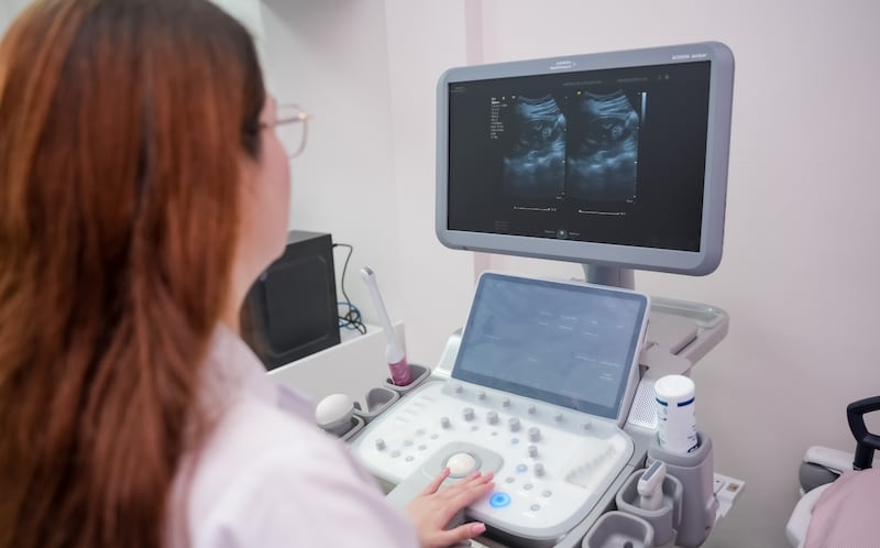 Uma máquina de ultrassom especializada doada por A Igreja de Jesus Cristo dos Santos dos Últimos Dias encontra-se no interior da nova clínica de mulheres do Hospital de Ensino Carlos Roberto Huembes em Manágua, Nicarágua, em 4 de setembro de 2026.